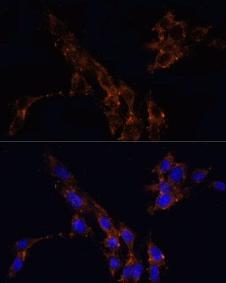 TGFB1 / TGF Beta 1 Antibody