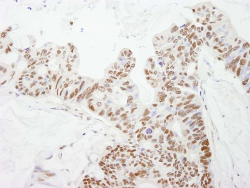 DFFA / ICAD / DFF45 Antibody (aa271-331)