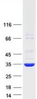 Human NFKBID / IkappaBNS Protein (Recombinant Myc-DDK (Flag))