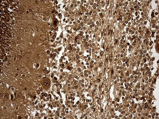 Monoclonal Mouse anti-Human KPNB1 / Importin Beta Antibody (clone OTI10B7, aa1-200, IHC, WB)
