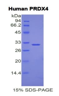 Human PRDX4 / Peroxiredoxin 4 Protein (Recombinant His)