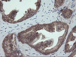 PDIA3 / ERp57 Antibody (clone OTI3E1)
