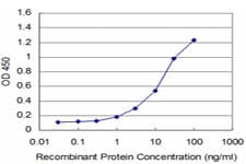 IHC-plus™ Monoclonal Mouse anti-Human LIMK1 / LIMK Antibody (clone 2E9, IHC, WB)