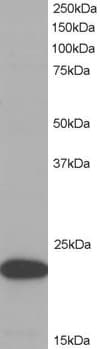IHC-plus™ PYCARD / ASC / TMS1 Antibody (aa182-195)