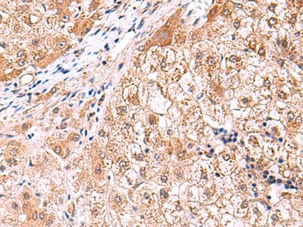 FDFT1 / Squalene Synthase Antibody
