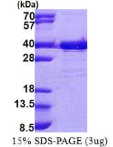 Human EMC2 / TTC35 Protein (Recombinant His)