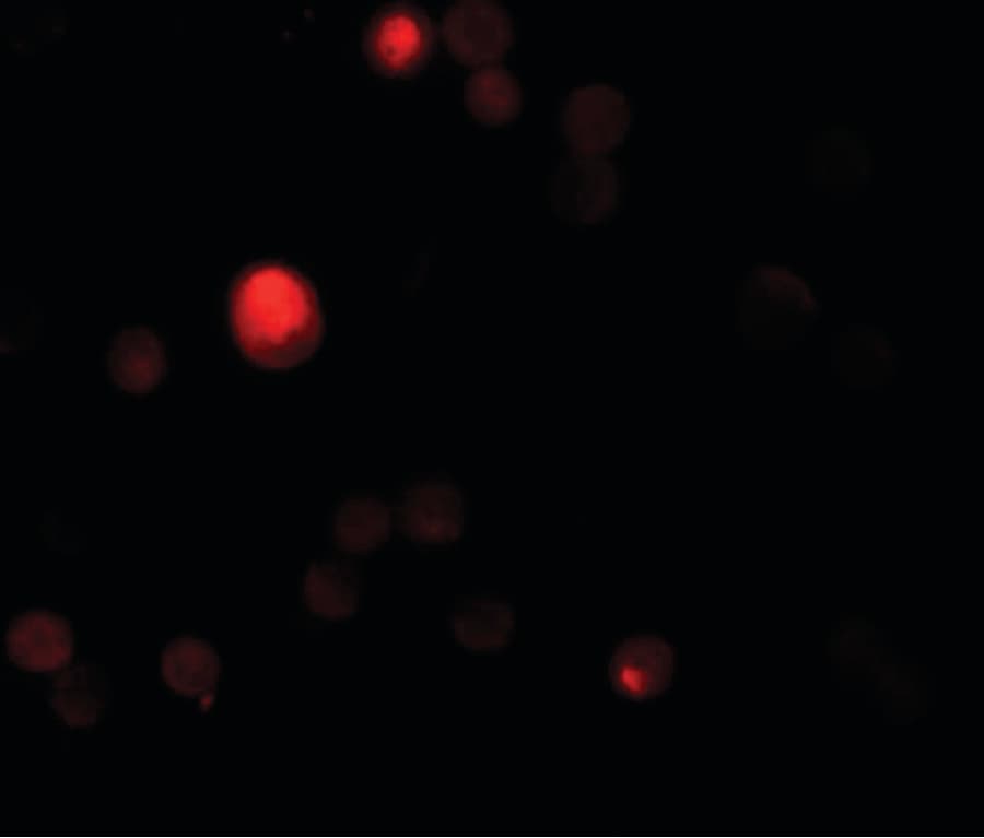 TCTN3 Antibody