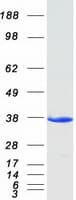 Human EFHD1 Protein (Recombinant Myc-DDK (Flag))