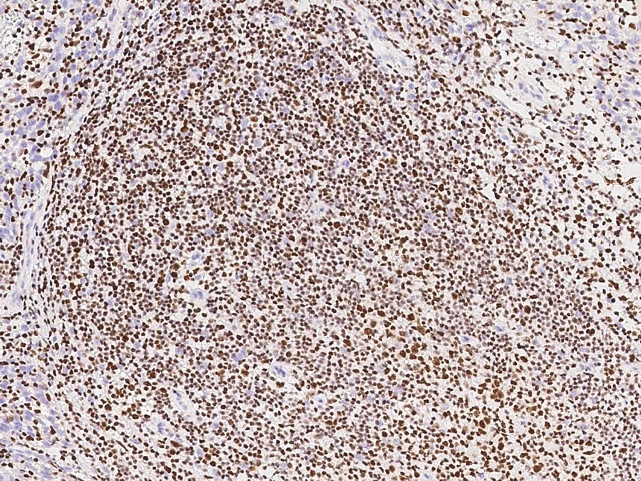 IKZF1 / IKAROS Antibody