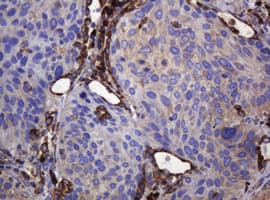 Monoclonal Mouse anti-Human POGK Antibody (clone OTI3E2, IHC, WB)
