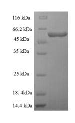 Human TARS2 / TARSL1 Protein (Recombinant 6His-SUMO, N-terminus)