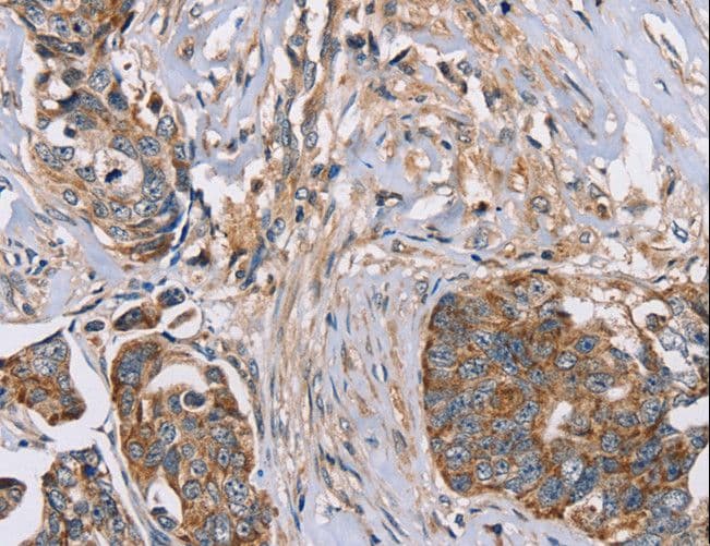 FAIM2 / LIFEGUARD Antibody
