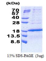 Human PCNA-Associated Factor Protein (Recombinant His)