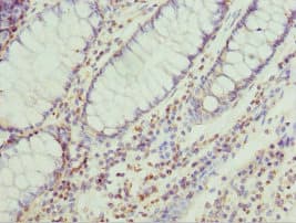 Polyclonal Rabbit anti-Human HT2A / TRIM32 Antibody (IHC)