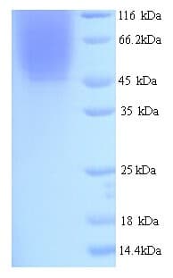 Human IDO1 / IDO Protein (Recombinant 6His, N-terminus)