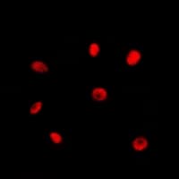 Polyclonal Rabbit anti-Human RAD21 Antibody (C-Terminus, IHC, IF, WB)