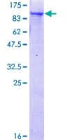 Human RINT1 Protein (Recombinant GST)