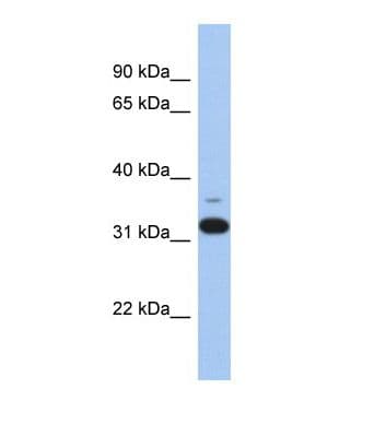 Polyclonal Rabbit anti-Human ANTXR2 / CMG2 Antibody (aa85-134, WB)