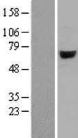 ARSJ / Arylsulfatase J Protein (Over-Expression Lysate Myc-DDK (Flag))
