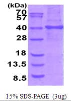 Human STOML1 Protein (Recombinant His)