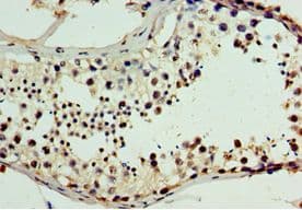 Polyclonal Rabbit anti-Human CHD2 Antibody (aa1569-1828, IHC)