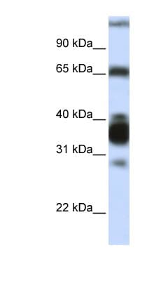 ARG1 / Arginase 1 Antibody (N-Terminus)