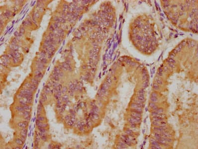 LPAR4 / GPR23 Antibody
