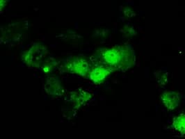 ERCC1 Antibody (clone OTI2D8)
