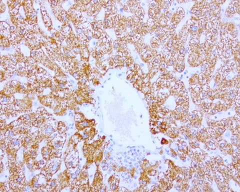 ABAT Antibody (aa29-323, clone UMAB179, Carrier-free)
