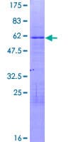 Human ZNF75A Protein (Recombinant GST)