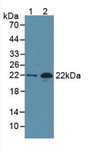 NT-proBNP Antibody (APC)