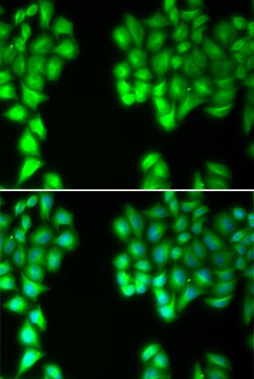 MALT1 Antibody