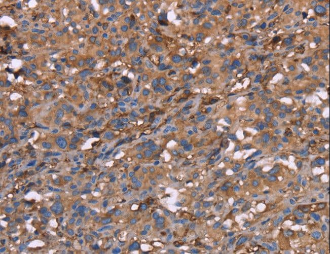 HP / Haptoglobin Antibody