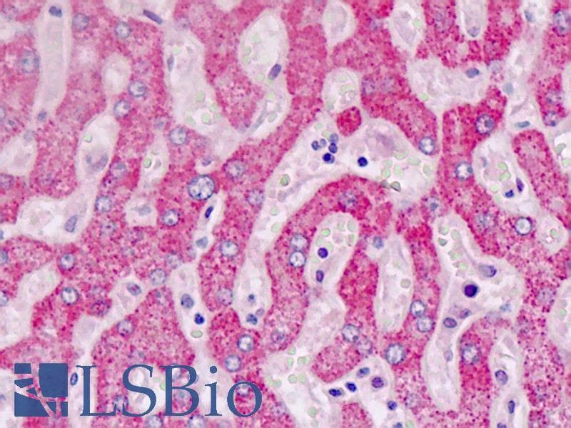 IHC-plus™ ALDH5A1 Antibody (aa368-398)