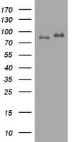 Monoclonal Mouse anti-Human NBN / Nibrin Antibody (clone OTI8E7, IHC, WB)