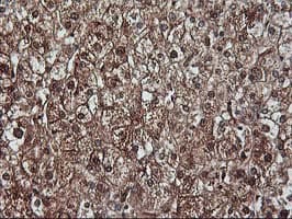 KCNAB1 Antibody (clone OTI7C7)