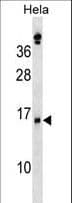 SLPI / Antileukoproteinase Antibody (aa59-88)