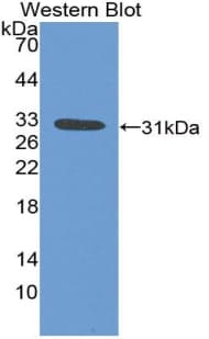 FCN1 / Ficolin-1 Antibody (aa25-279)