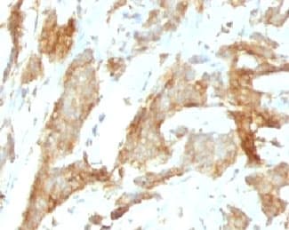 HSP90B1 / GP96 / GRP94 Antibody (clone SPM249)
