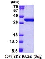 Human NSMCE1 Protein (Recombinant His)