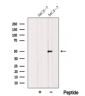 RARG / RAR-Gamma Antibody