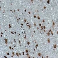 CACNG4 Antibody