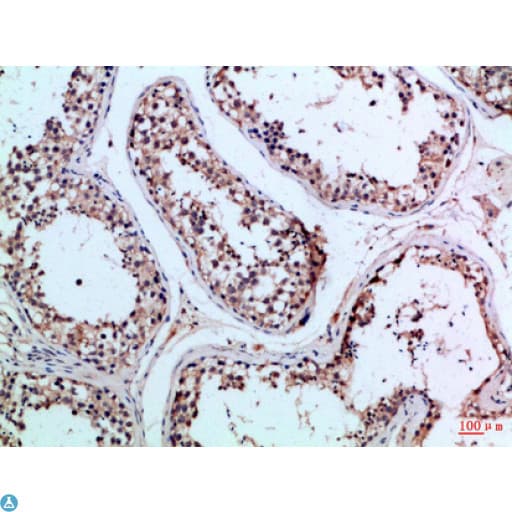 PIK3R2 / p85 Beta Antibody