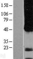 APH1A / APH-1 Protein (Over-Expression Lysate Myc-DDK (Flag))