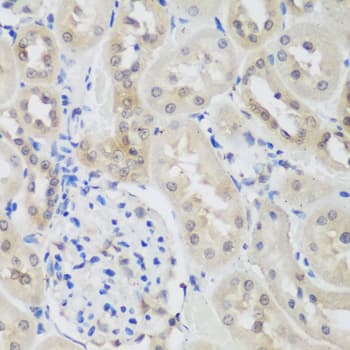 E6AP / UBE3A Antibody