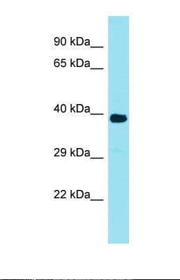 FAM166A Antibody (aa130-179)