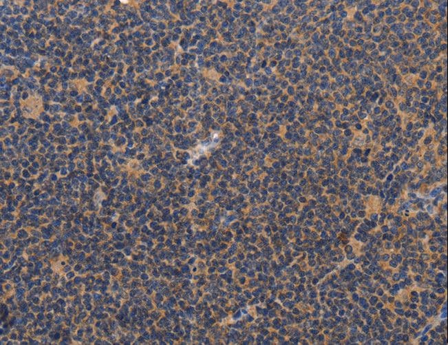 Polyclonal Rabbit anti-Human CCL23 / MIP3 Antibody (IHC)