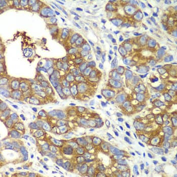 Polyclonal Rabbit anti-Human GLNRS / QARS Antibody (IHC, IF, WB)