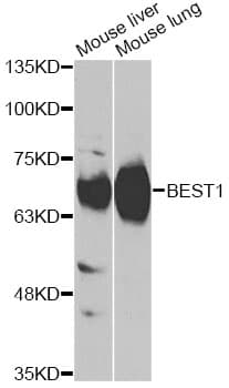 BEST1 / BEST / Bestrophin Antibody