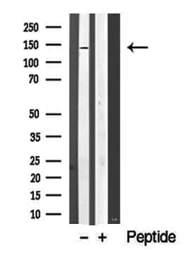 SIK1 / MSK Antibody